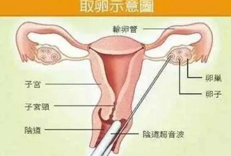 女人一个月只排一个卵子吗？深度解析女性生理奥秘